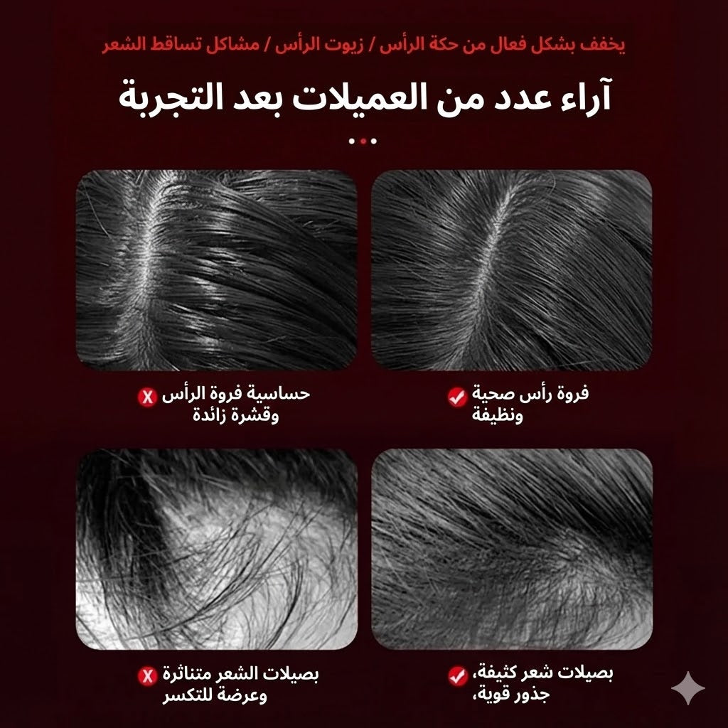 ScalpCare مشط  لتدليك فروة الرأس الثوري